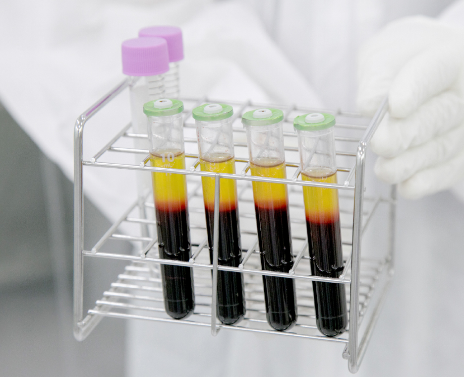 PFC-FD™ 2.0 & PRP Therapies